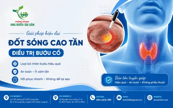 Đốt sóng cao tần tuyến giáp (RFA): Giải pháp điều trị ít xâm lấn giúp bảo tồn tuyến giáp