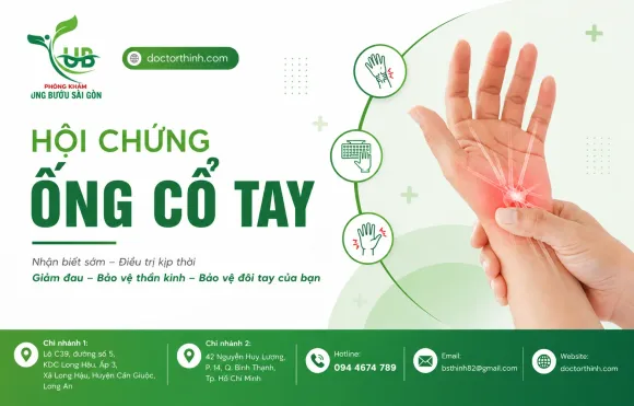 Hội Chứng Ống Cổ Tay: Dấu Hiệu Cảnh Báo, Nguyên Nhân Và Cách Điều Trị Hiệu Quả