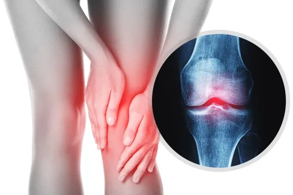 Bí Mật Về Hệ Cơ Xương Khớp: Chức Năng, Bệnh Thường Gặp & Cách Bảo Vệ